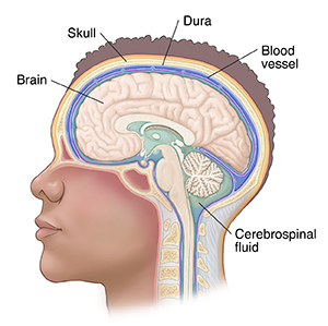 Side view of head and brain showing meninges and cerebrospinal fluid.